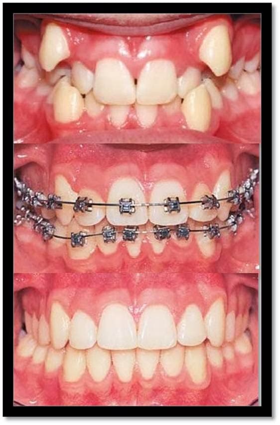 Dentista experiente cuidando de um paciente